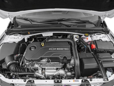 2017 Chevrolet Malibu 1LT